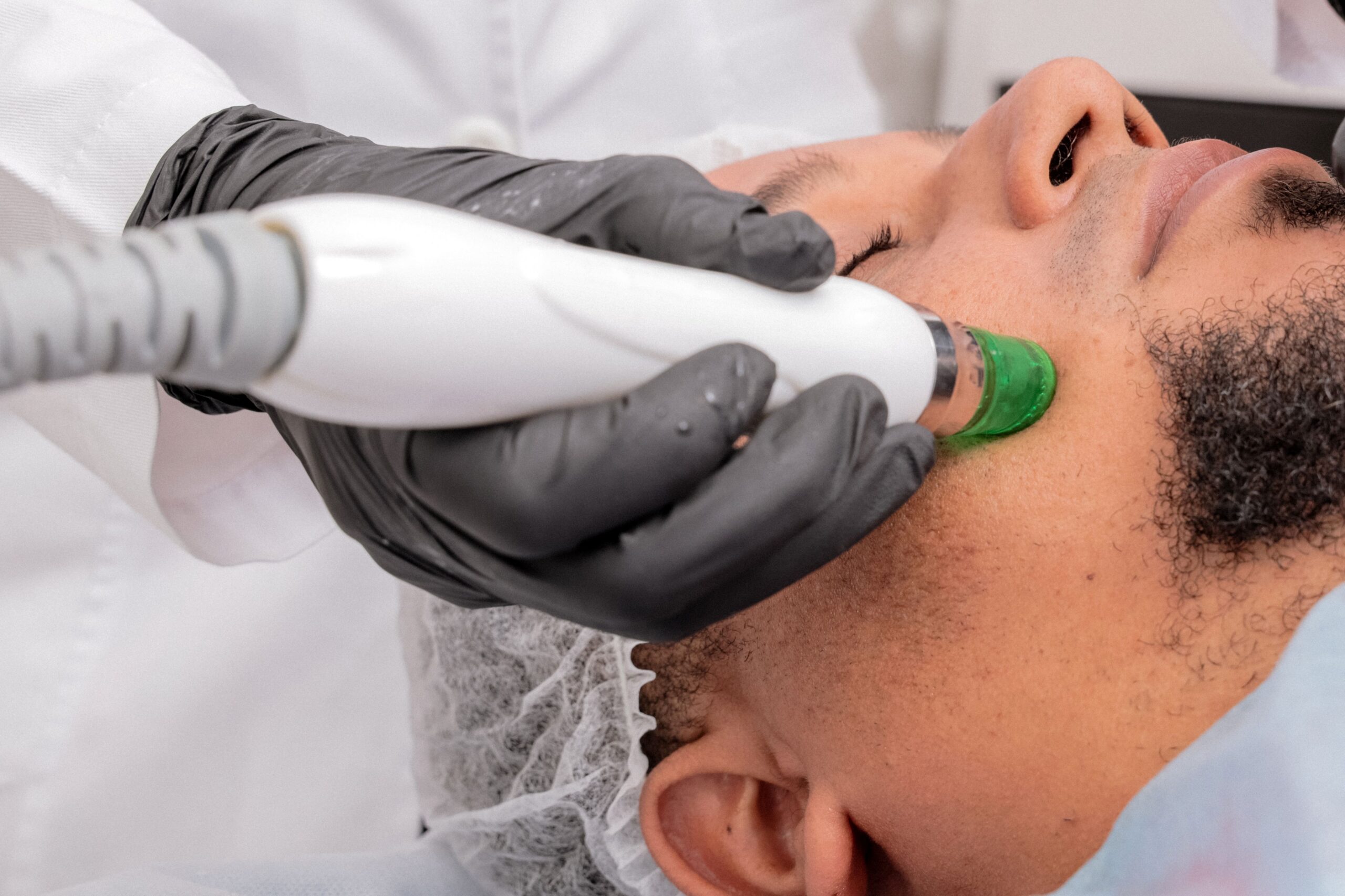 Patient receiving a dermabrasion treatment at a medspa